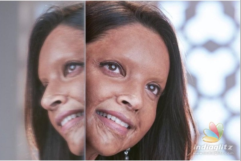 Deepika Padukone’s Pic As Malti From ‘Chhapaak’ Goes Viral!