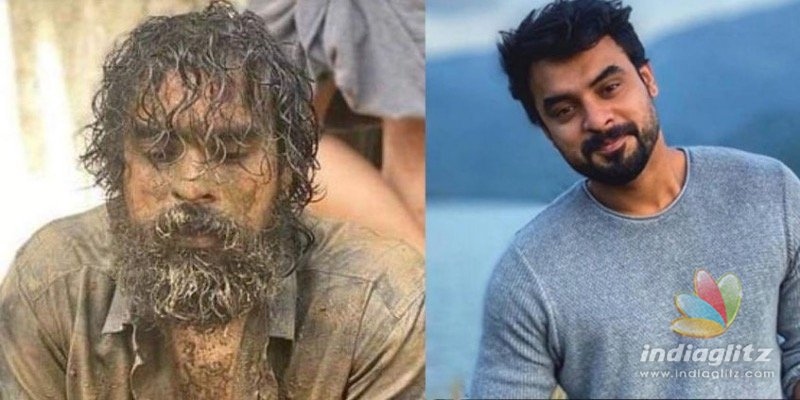 Tovino Thomas injured on film set; admitted to ICU