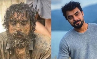 Tovino Thomas injured on film set; admitted to ICU