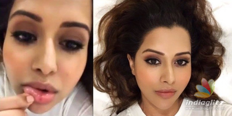 Raiza Wilson hurt in a selfie accident