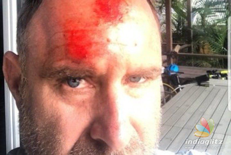 Former Australian/CSK cricketer Mathew Hayden seriously injured in freak accident