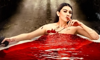 Hansika Motwani gets hurt!