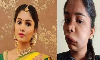 Shocking! Actress Swathi Sathish face disfigured after wrong medical procedure