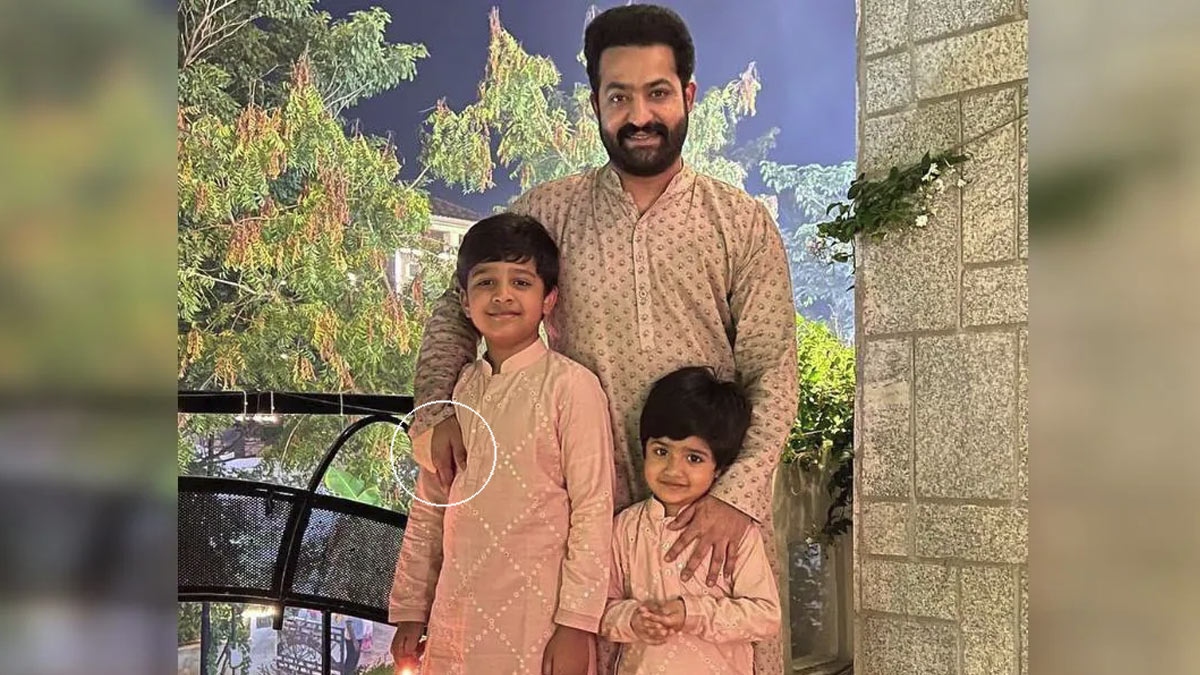 Jr NTR undergoes minor surgery - find out more