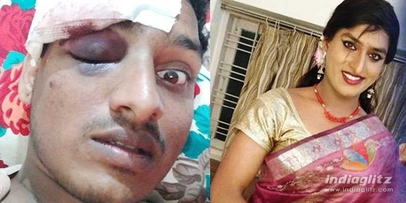 Jabardasth Vinodini severely injured in attack